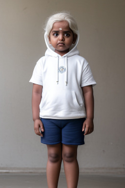 Sri lankan infant girl with  white hair