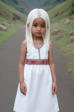 Nepalese child girl with  white hair