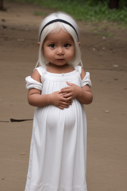 Bolivian infant girl with  white hair