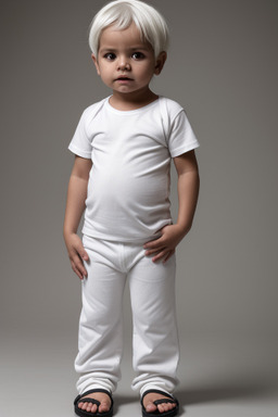 Nicaraguan infant boy with  white hair