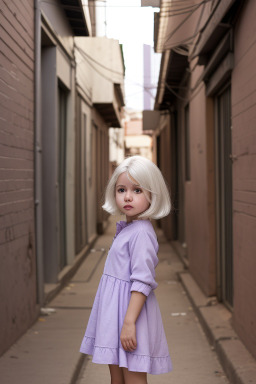 Paraguayan infant girl with  white hair