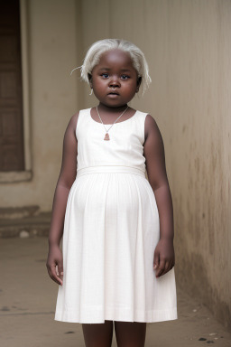 Tanzanian child girl with  white hair