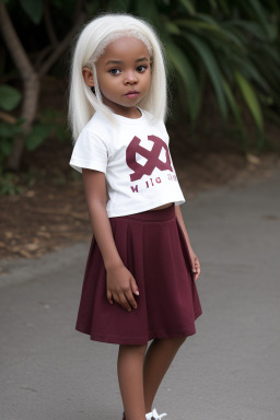 Jamaican infant girl with  white hair