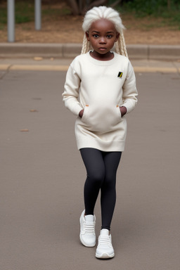 Zimbabwean infant girl with  white hair