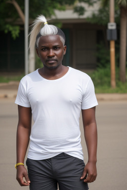 Ugandan adult male with  white hair